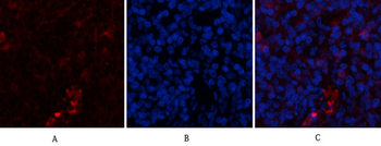 α-SMA Polyclonal Antibody