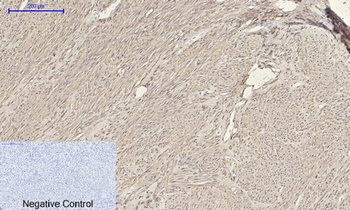 α-SMA Polyclonal Antibody