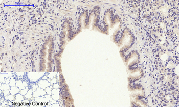 Bcl-2 Polyclonal Antibody