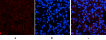 Amyloid-β Polyclonal Antibody