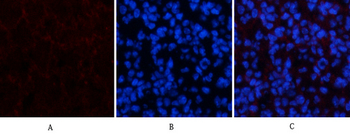 Amyloid-β Polyclonal Antibody
