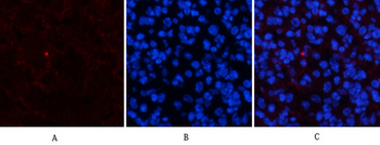 Amyloid-β Polyclonal Antibody