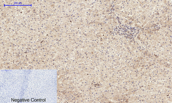 Amyloid-β Polyclonal Antibody