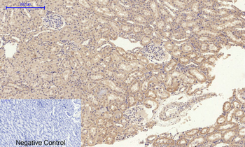 Amyloid-β Polyclonal Antibody