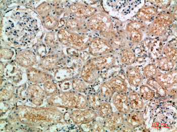 TLE1/2/3/4 Polyclonal Antibody