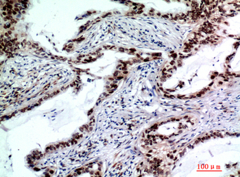 TP53INP2 Polyclonal Antibody