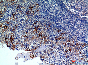 CMTM8 Polyclonal Antibody