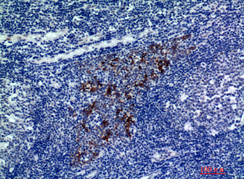 CMTM8 Polyclonal Antibody