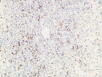 CD72 Polyclonal Antibody