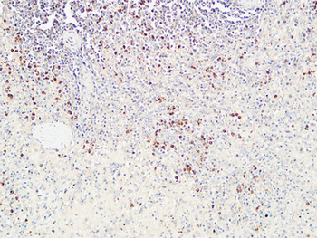 CD72 Polyclonal Antibody
