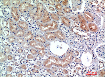 CD26 Polyclonal Antibody