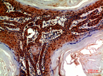ADAMTS-18 Polyclonal Antibody