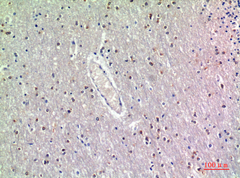 GDF-7 Polyclonal Antibody