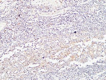 BMP-15 Polyclonal Antibody