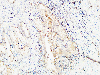 BMP-15 Polyclonal Antibody