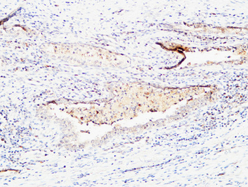 BMP-15 Polyclonal Antibody