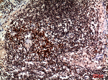CD244 Polyclonal Antibody