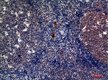 P-Selectin Polyclonal Antibody