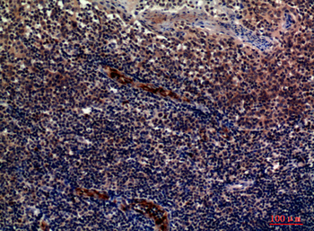 P-Selectin Polyclonal Antibody