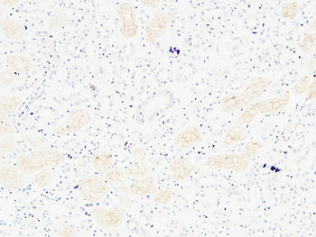CD13 Polyclonal Antibody