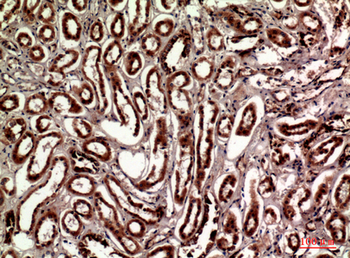 Talin-1 Polyclonal Antibody