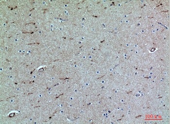 PSGL-1 Polyclonal Antibody