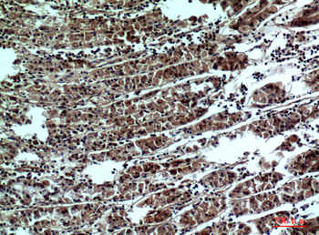 PPP1R15B Polyclonal Antibody