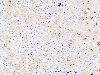 IL-3Rα Polyclonal Antibody