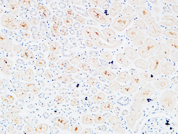 IL-3Rα Polyclonal Antibody