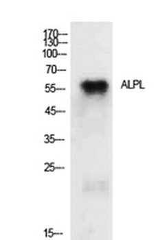TNAP Polyclonal Antibody