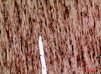 AAT Polyclonal Antibody