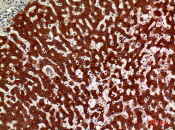 11β-HSD1 Polyclonal Antibody