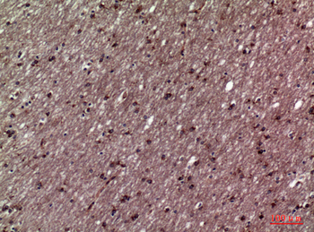 11β-HSD1 Polyclonal Antibody