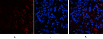 ABCG2 Polyclonal Antibody