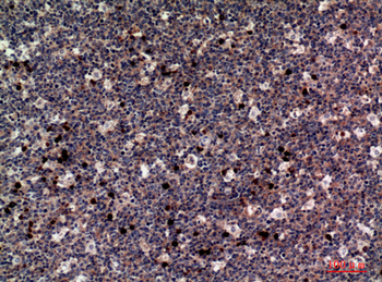 M-CSF Polyclonal Antibody