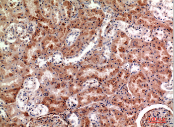 M-CSF Polyclonal Antibody