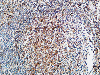 M-CSF Polyclonal Antibody