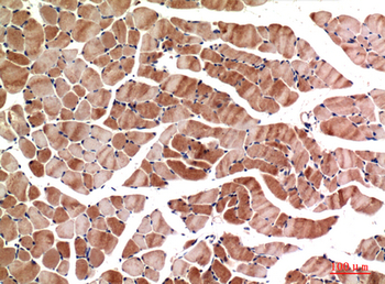 MyoD Polyclonal Antibody