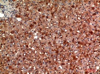 ANG I Polyclonal Antibody
