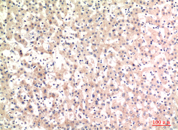 C4a/b Polyclonal Antibody