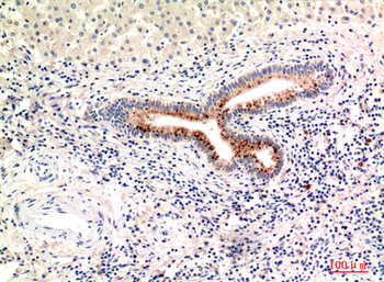 C4a/b Polyclonal Antibody