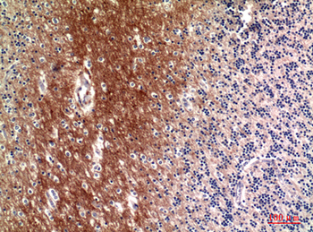 C4a/b Polyclonal Antibody