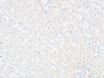 C4a/b Polyclonal Antibody