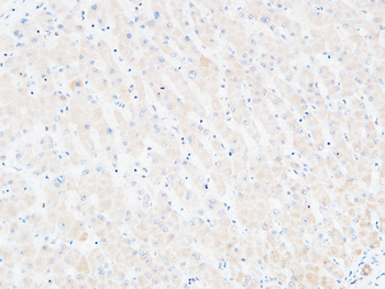 C4a/b Polyclonal Antibody