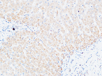 C4a/b Polyclonal Antibody
