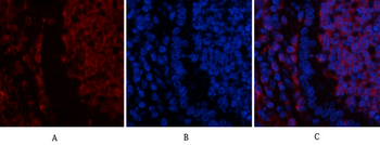 Ub Polyclonal Antibody