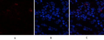 AR Polyclonal Antibody