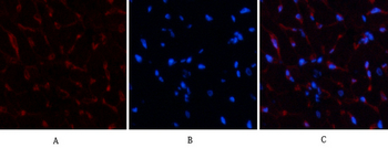 AR Polyclonal Antibody
