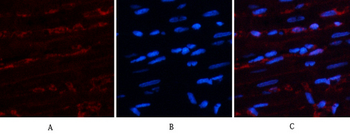 AR Polyclonal Antibody