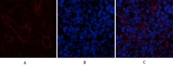 AR Polyclonal Antibody